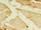 Myosin-7B antibody, A59970-100, Epigentek, Immunohistochemistry paraffin image 