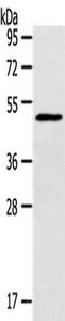 Sialic acid-binding Ig-like lectin 15 antibody, TA351670, Origene, Western Blot image 