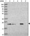 Secretion Associated Ras Related GTPase 1B antibody, NBP2-33521, Novus Biologicals, Western Blot image 