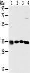 Mitochondrial Ribosomal Protein L39 antibody, TA350184, Origene, Western Blot image 