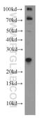 KRAS Proto-Oncogene, GTPase antibody, 16156-1-AP, Proteintech Group, Western Blot image 