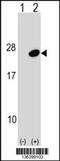 Ubiquitin Conjugating Enzyme E2 G1 antibody, 58-992, ProSci, Western Blot image 