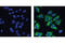Ribosomal Protein S6 antibody, 4803S, Cell Signaling Technology, Immunocytochemistry image 