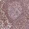 DDX11 antibody, NBP2-38060, Novus Biologicals, Immunohistochemistry paraffin image 