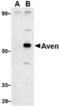 Cell death regulator Aven antibody, TA306068, Origene, Western Blot image 