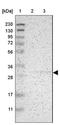 Potassium Calcium-Activated Channel Subfamily M Regulatory Beta Subunit 3 antibody, NBP1-83066, Novus Biologicals, Western Blot image 
