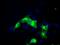 Scianna blood group antigen antibody, MA5-25042, Invitrogen Antibodies, Immunocytochemistry image 