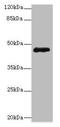 Zinc Finger Protein 562 antibody, A63948-100, Epigentek, Western Blot image 