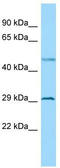 BTB Domain Containing 7 antibody, TA333756, Origene, Western Blot image 
