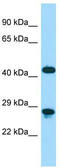 Diencephalon/mesencephalon homeobox protein 1 antibody, TA345533, Origene, Western Blot image 