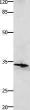 POMC antibody, TA323524, Origene, Western Blot image 
