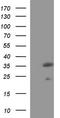 Vascular Endothelial Growth Factor B antibody, TA590656, Origene, Western Blot image 