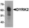 Dual specificity tyrosine-phosphorylation-regulated kinase 2 antibody, LS-B7095, Lifespan Biosciences, Western Blot image 
