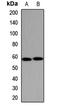 Cytochrome P450 Family 1 Subfamily A Member 2 antibody, orb411598, Biorbyt, Western Blot image 