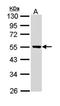Aldehyde Dehydrogenase 3 Family Member B2 antibody, orb69828, Biorbyt, Western Blot image 