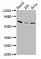 antibody, CSB-PA005279LA01HU, Cusabio, Western Blot image 