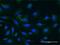 Phosducin-like protein 3 antibody, H00079031-M02, Novus Biologicals, Immunocytochemistry image 
