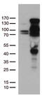 Progesterone Receptor antibody, TA805174, Origene, Western Blot image 