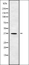 BAL antibody, orb338075, Biorbyt, Western Blot image 