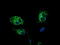 3-Hydroxyisobutyryl-CoA Hydrolase antibody, LS-C115376, Lifespan Biosciences, Immunofluorescence image 