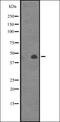 Calcium Activated Nucleotidase 1 antibody, orb335400, Biorbyt, Western Blot image 