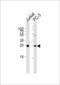 High Mobility Group Box 4 antibody, 59-415, ProSci, Western Blot image 