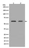 ETS domain-containing protein Elk-1 antibody, M01426, Boster Biological Technology, Western Blot image 