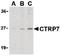 C1q And TNF Related 7 antibody, orb86704, Biorbyt, Western Blot image 