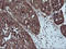 LIM Domain Kinase 1 antibody, LS-C172767, Lifespan Biosciences, Immunohistochemistry paraffin image 