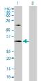 MRT4 Homolog, Ribosome Maturation Factor antibody, H00051154-D01P, Novus Biologicals, Western Blot image 