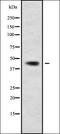 Aldehyde Dehydrogenase 3 Family Member B2 antibody, orb337984, Biorbyt, Western Blot image 