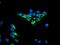 Dihydrolipoamide Dehydrogenase antibody, MA5-25663, Invitrogen Antibodies, Immunocytochemistry image 