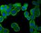 Phosphofructokinase, Muscle antibody, A04370-2, Boster Biological Technology, Immunocytochemistry image 