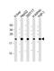Glutathione Peroxidase 1 antibody, GTX03346, GeneTex, Western Blot image 