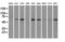 Nuclear Receptor Binding Protein 1 antibody, GTX84000, GeneTex, Western Blot image 