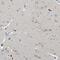Serine Protease 12 antibody, NBP1-89925, Novus Biologicals, Immunohistochemistry paraffin image 
