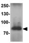 WW Domain Containing Adaptor With Coiled-Coil antibody, GTX32115, GeneTex, Western Blot image 