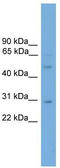 Doublesex And Mab-3 Related Transcription Factor 3 antibody, TA329617, Origene, Western Blot image 