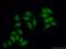 IMP U3 Small Nucleolar Ribonucleoprotein 3 antibody, 12750-1-AP, Proteintech Group, Immunofluorescence image 