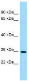 UDP-glucuronic acid/UDP-N-acetylgalactosamine transporter antibody, TA333845, Origene, Western Blot image 