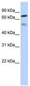 Dual Specificity Phosphatase 8 antibody, TA340054, Origene, Western Blot image 