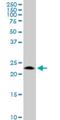 Germinal Center Associated Signaling And Motility antibody, H00257144-M19, Novus Biologicals, Western Blot image 