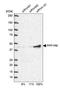 Protein Phosphatase 1 Regulatory Subunit 8 antibody, HPA027406, Atlas Antibodies, Western Blot image 
