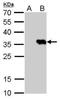 Herpes Simplex Virus tag antibody, NBP2-43816, Novus Biologicals, Western Blot image 