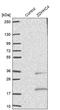 Zinc Finger DHHC-Type Containing 4 antibody, PA5-56936, Invitrogen Antibodies, Western Blot image 