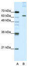 Pumilio RNA Binding Family Member 3 antibody, TA345758, Origene, Western Blot image 