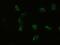 Pancreatic And Duodenal Homeobox 1 antibody, LS-C114333, Lifespan Biosciences, Immunocytochemistry image 