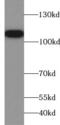 Amphiphysin antibody, FNab00373, FineTest, Western Blot image 