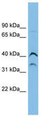 Ankyrin Repeat And SOCS Box Containing 7 antibody, TA337610, Origene, Western Blot image 