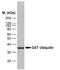 Glutathione-S-Transferase Tag antibody, SM1690B, Origene, Western Blot image 